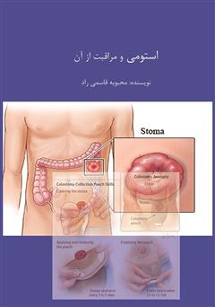 دانلود کتاب استومی و مراقبت از آن